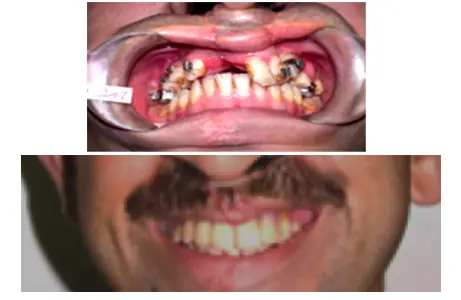 Case Study 07 — before and after orthodontic treatment