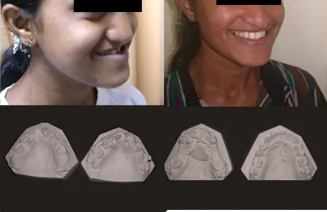 Case Study 08 — before and after orthodontic treatment