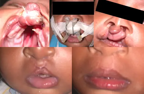 Case Study 09 — before and after orthodontic treatment