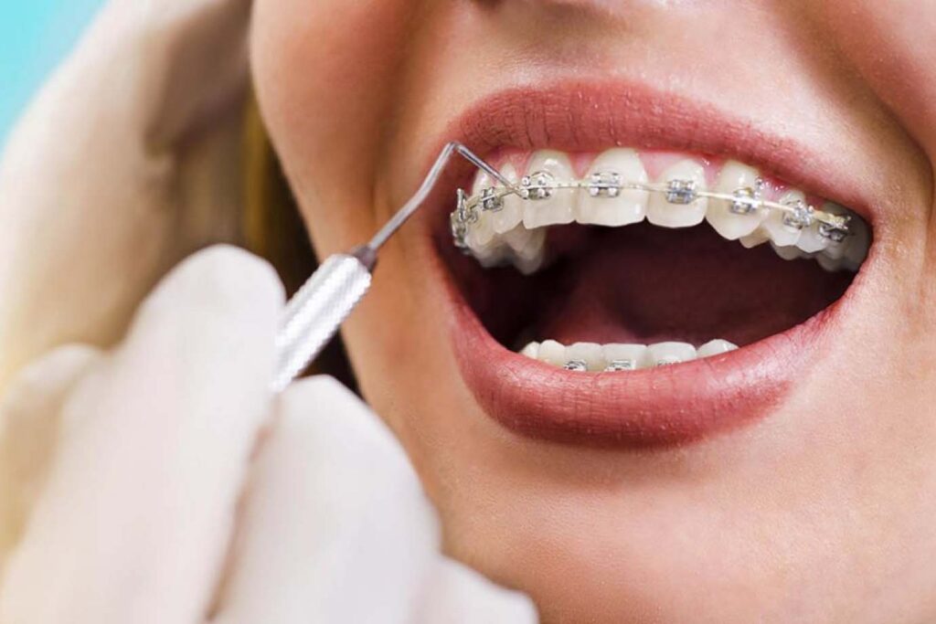 Interceptive Orthodontics